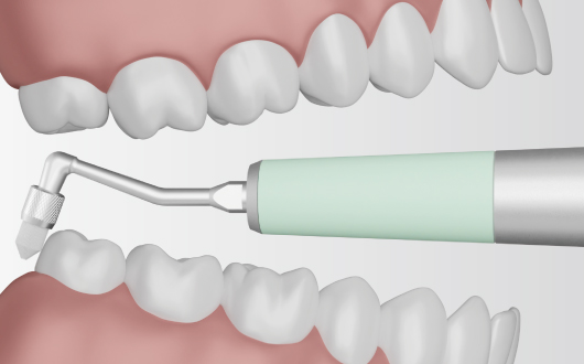 使いやすい形状